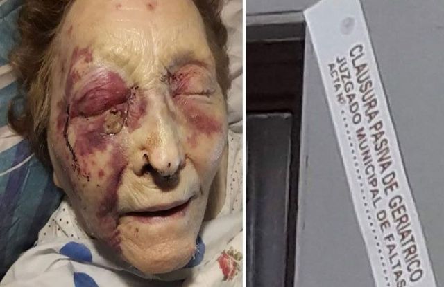 Tiene 93 años y fue golpeada brutalmente en el asilo donde vive