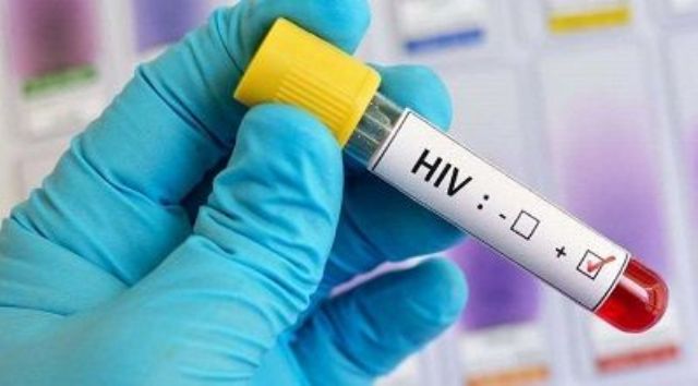 Por primera vez en 10 años, una vacuna contra el VIH llega a la última fase de ensayos