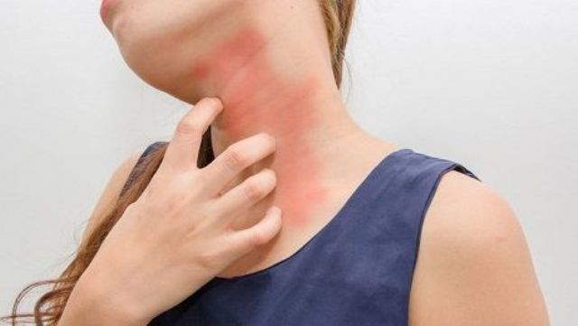 Las alergias están entre las seis patologías más frecuentes