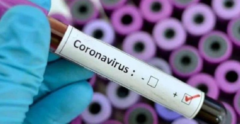 Covid: Récord de contagios para un sábado: hubo 21.220 casos. En Mercedes una muerte más.