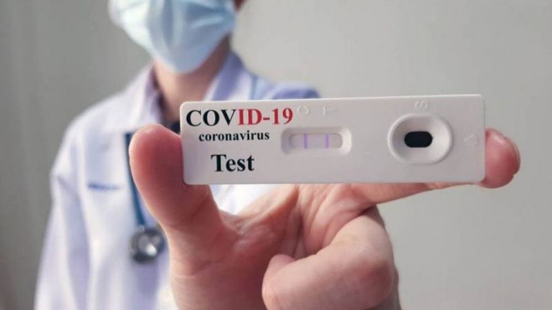 Los autotest de coronavirus estarán disponibles la semana próxima en farmacias a 1.560 pesos
