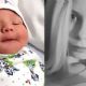 Le cortaron la cara a una beba durante la cesárea y dicen que fue porque 