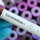 Coronavirus Mercedes: un nuevo caso positivo