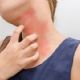 Las alergias están entre las seis patologías más frecuentes