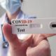 Los autotest de coronavirus estarán disponibles la semana próxima en farmacias a 1.560 pesos