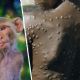 OMS: reunión de emergencia por el aumento de casos de viruela del mono